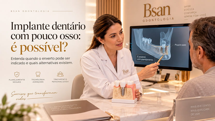 Implante dentário com pouco osso: é possível?