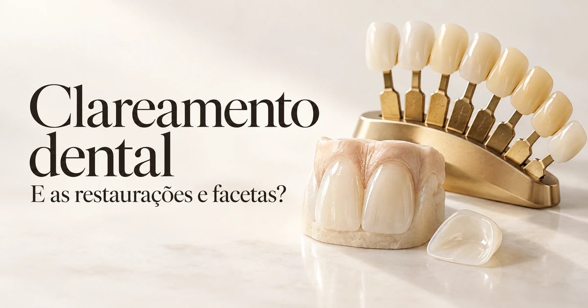 Clareamento dental clareia restaurações e facetas?